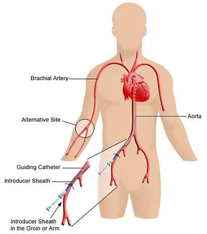 img_interventionalprocedures